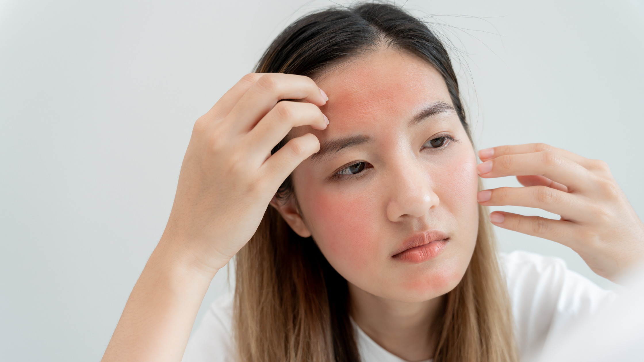 How to Manage Histamine Reactions for Healthier Skin