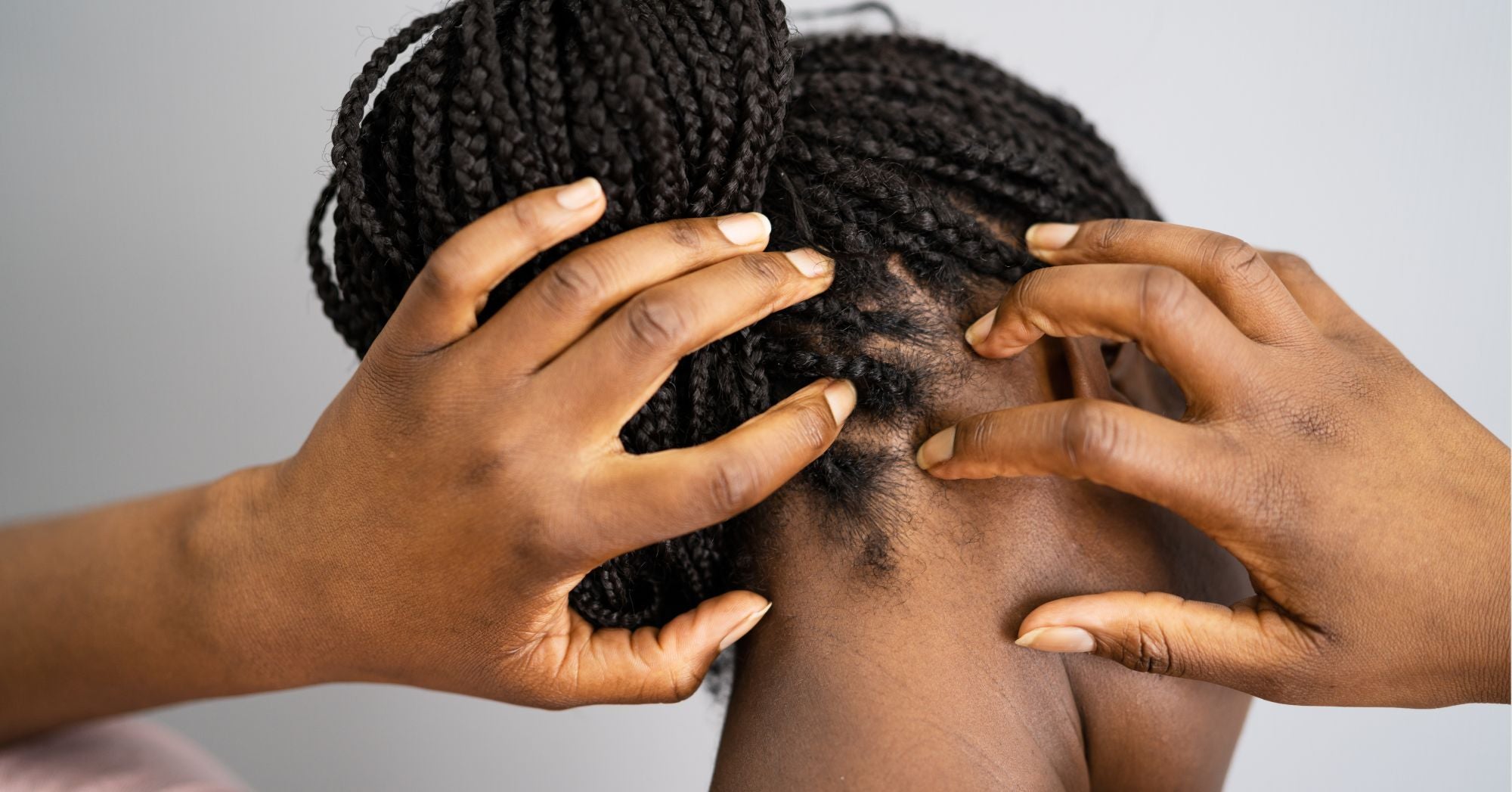 The Ultimate Guide to Soothing Your Scalp with Braids and Extensions